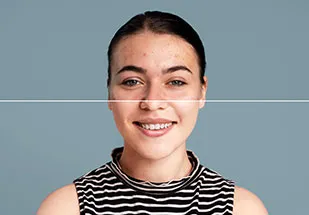 Anti-Taches-&-eclat-du-teint