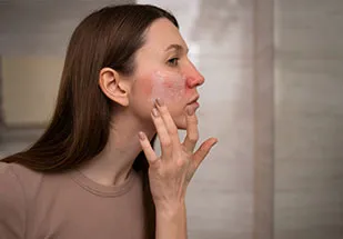 Soins des cicatrices